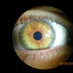 Augen- und Irisdiagnose