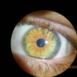 Augen- und Irisdiagnose