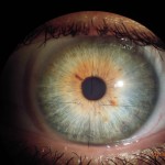 Augen- und Irisdiagnose