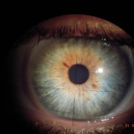 Augen- und Irisdiagnose