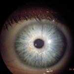 Augen- und Irisdiagnose